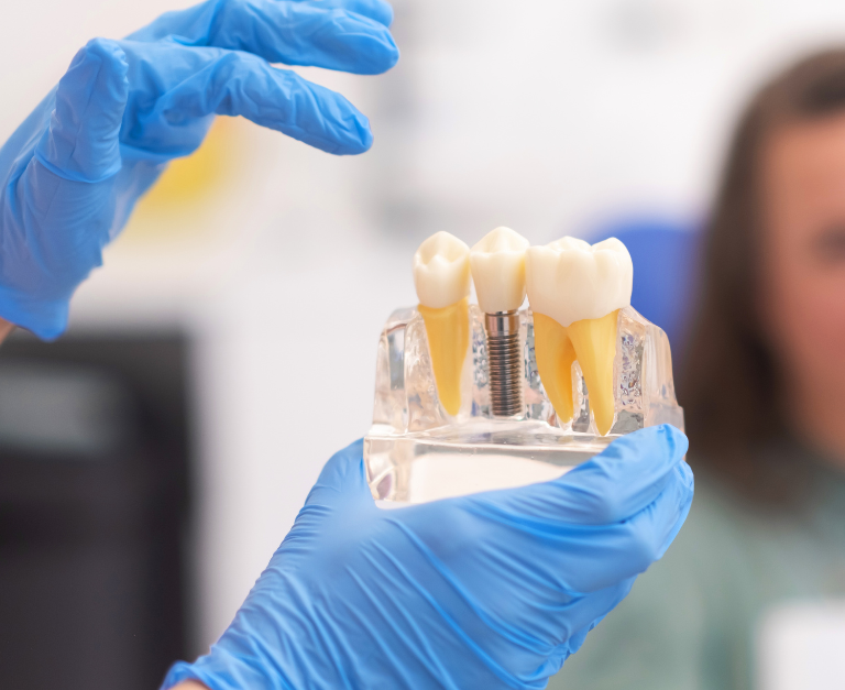 Zirkonyum Kuron ve Köprü Protezleri